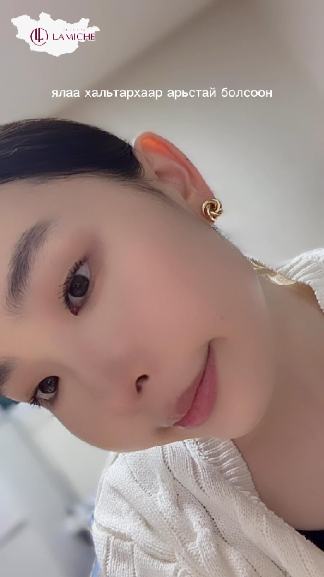 클럽 미즈 라미체 cducaa님 피부 케어 방문기